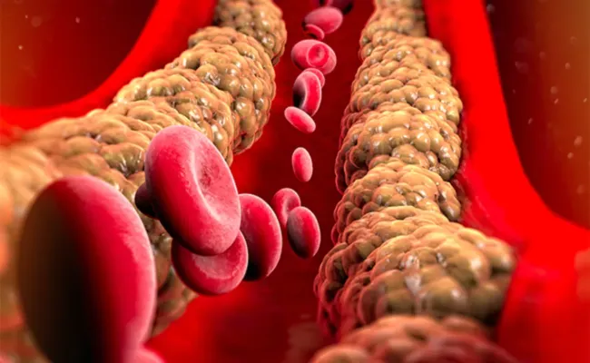 Киноа: полезный источник белка для восстановления после тренировок и улучшения здоровья сердца