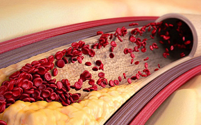 Верните сосудам молодость: 7 шагов к здоровью без стресса и лишений