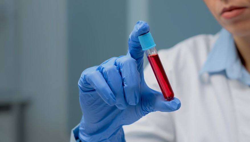 Продукты, которые разжижают кровь: добавьте лук и свеклу в рацион для здоровья сосудов