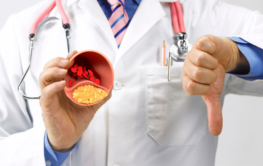 Свекла и другие овощи для снижения холестерина: простые шаги к здоровью сосудов